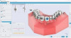 Maestro 3D Dental Studio V6