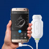 Echcardiographe portable PHILIPS Lumify.