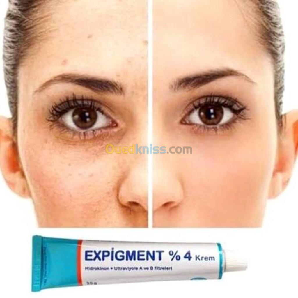 لعلاج التصبغات وآفات حب الشباب Expigment 4 كريم