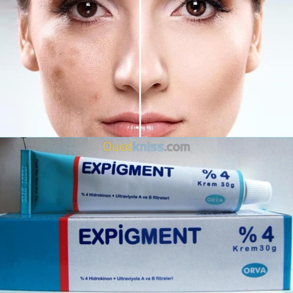 لعلاج التصبغات وآفات حب الشباب Expigment 4 كريم