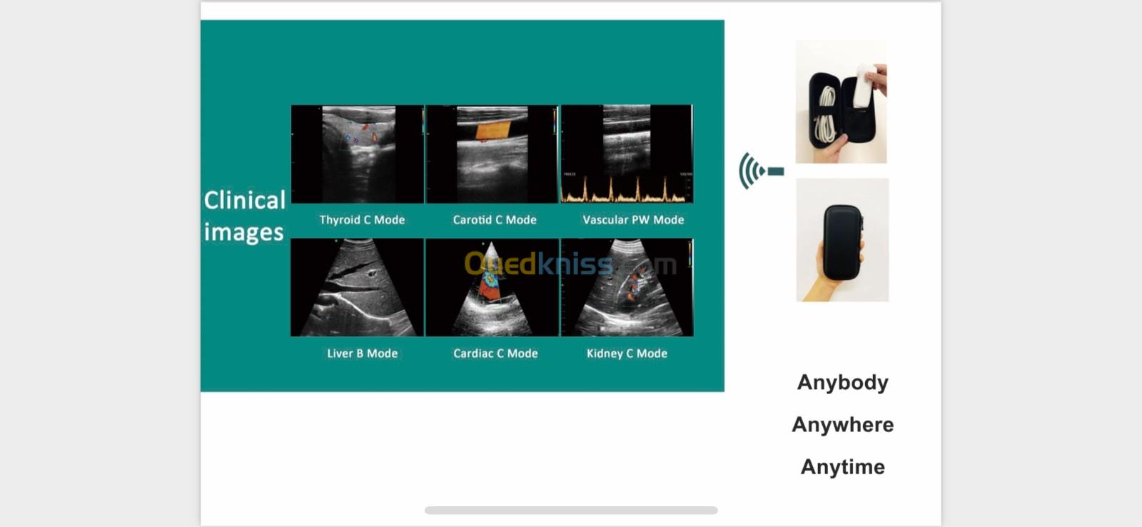 Échographe portable 
