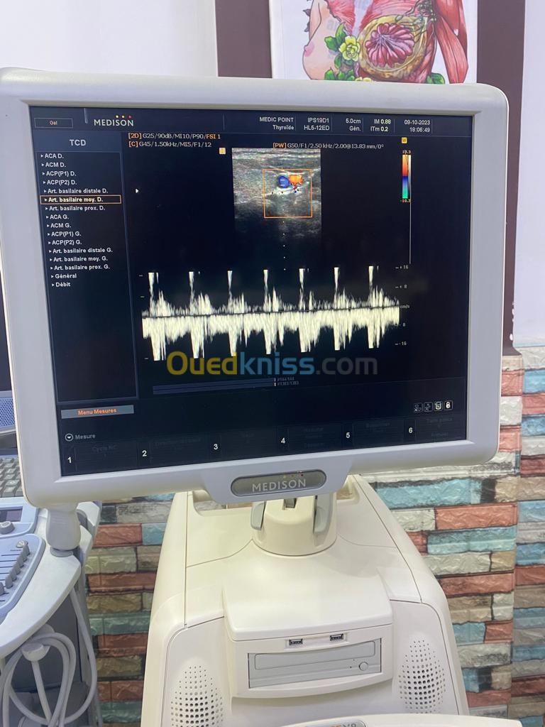 Échographe medison Sonoace X8 cardio