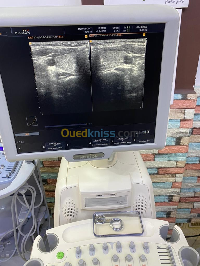 Échographe medison Sonoace X8 cardio