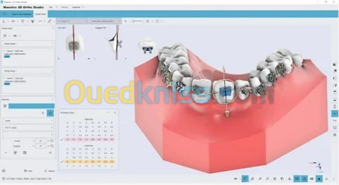 Maestro 3D Dental Studio V6