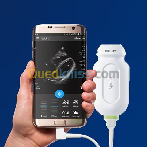 Echcardiographe portable PHILIPS Lumify.