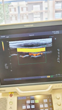 Echographe Toshiba xario XG