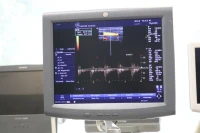 Echographe GE logiq P5 ( 3-4D)