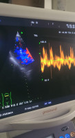 medical-echographe-aloka-alpha7-cardio-setif-algerie