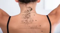 Détatouage laser oran tatouage et microblading 