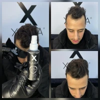 Pack Xara - fibres capillaire - Fixateur - Optilizer
