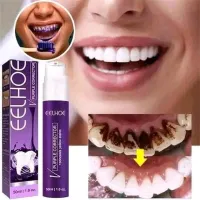 مبيض  للاسنان eelhoe