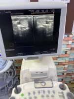 medical-echographe-medison-sonoace-x8-cardio-batna-algerie