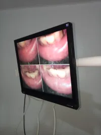 Caméra intra orale 
