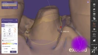 ExoCAD 3.2 Elefsina