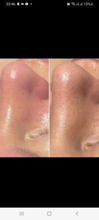 تجميل-و-جمال-estheticienne-propose-ses-services-البليدة-الجزائر