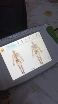Appareil de rééducation phenix portable physio