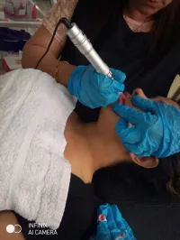 Formation microblading
