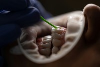 طب-و-صحة-chirurgien-dentiste-odf-9h00-a-17h00-عين-بنيان-الجزائر