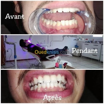 Smile care Clinic Chirurgien dentiste spécialiste en ODF 7/7 de 08h30 a 17h00
