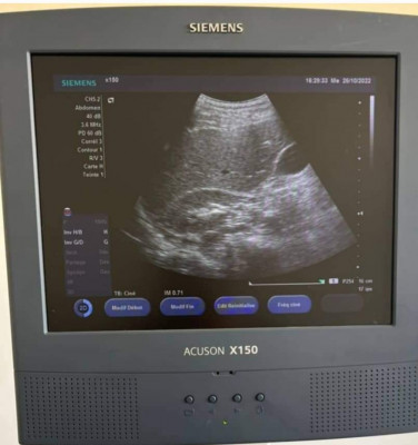 medical-siemens-acuson-x150-setif-algerie