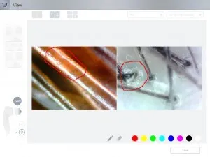 Microscope professionnel Aramo pour l'analyse de la peau, du cuir chevelu et des cheveux