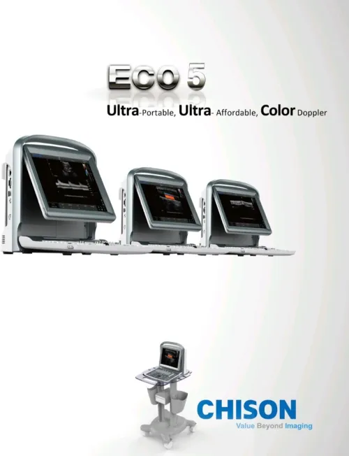 Échographie CHISON ECO 5