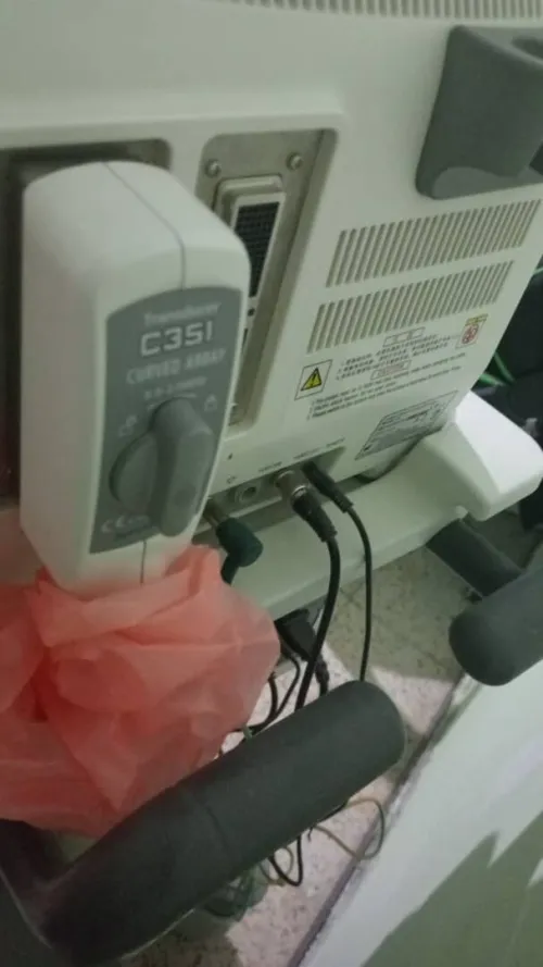 Echographe Sonoscape A6