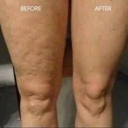 Crème anti cellulite soin du corps