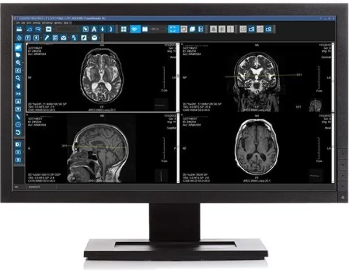 PACS Radiologie et Scanner CT Solution Complète imagerie Médicale