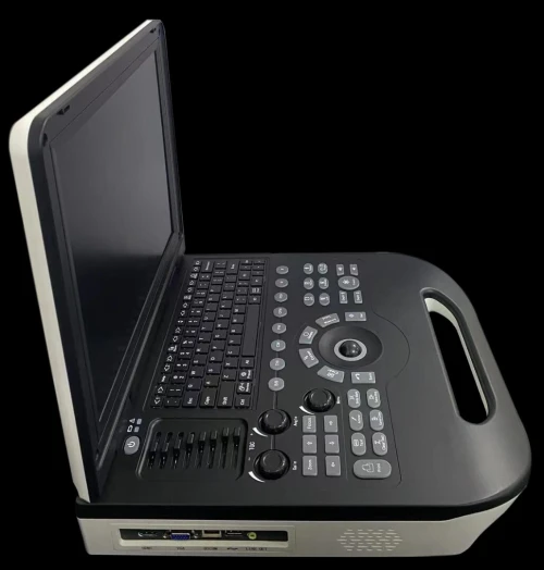 Échographe Portable XIANFENG E30 Doppler Couleur  Avec deux sondes (linéaire + convexe)