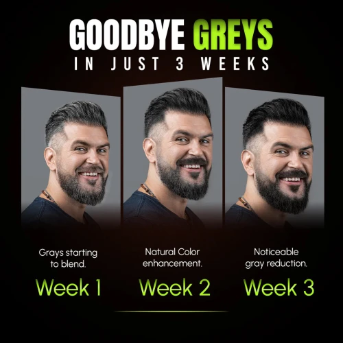 Herbishh Gray Reducing Shampoo- Anti Grey Hair