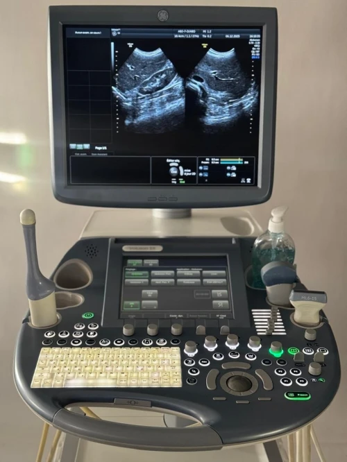 ECHOGRAPHE GE VOLUSON E6