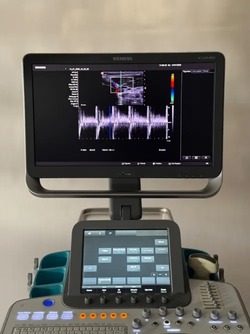 ECHOGRAPHE SIEMENS ACUSON NX3