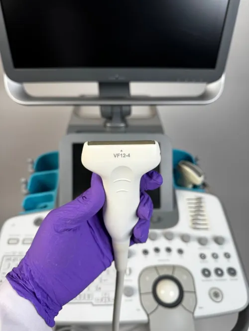 ECHOGRAPHE SIEMENS ACUSON NX3
