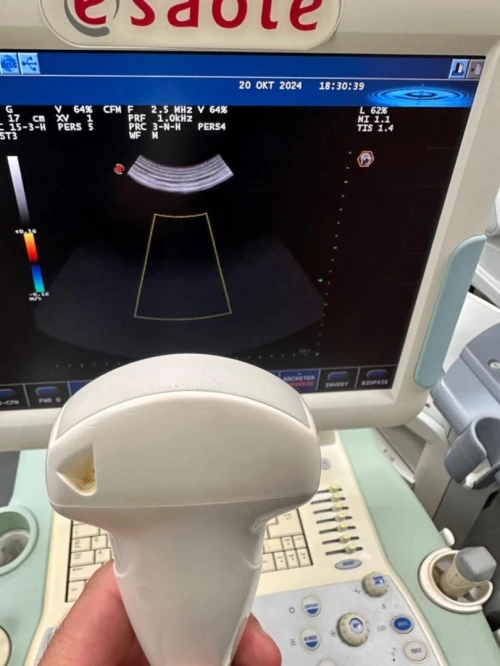 Sonde pour toute Echographe 