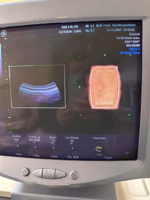 sonde echographe GE 