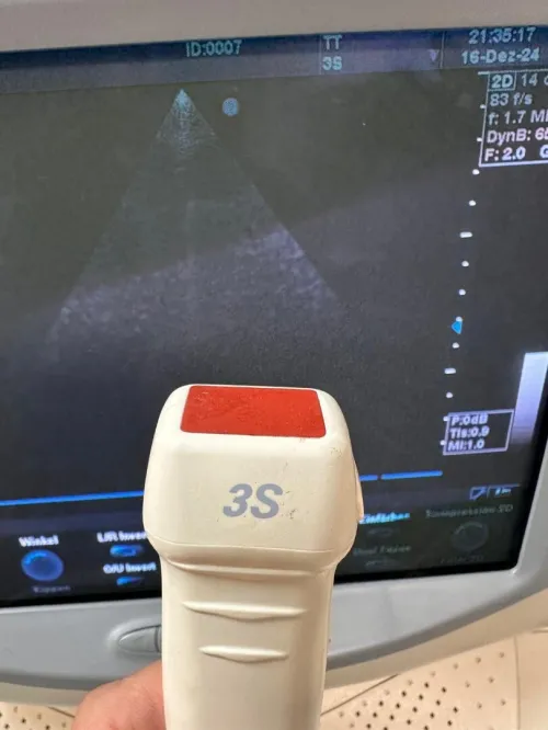 sonde echographe GE 