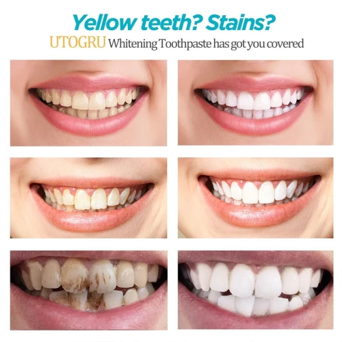 Dentifrice blanchissant à la niacinamide UTOGRU Triple action blanchissante  معجون تبييض الأسنان