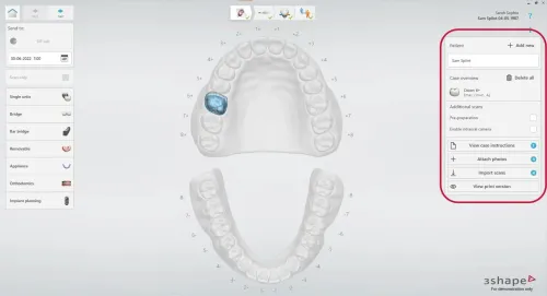 3shape Dental System 2022 + 3Shape Unite 2022 + 3shapeOrtho System 2022 + 3Shape Implant Studio 22 
