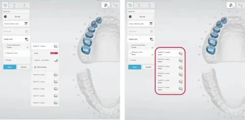 3shape Dental System 2022 + 3Shape Unite 2022 + 3shapeOrtho System 2022 + 3Shape Implant Studio 22 