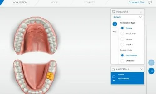 CEREC SW 5.2 Dentsply Sirona 2022