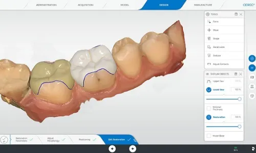 CEREC SW 5.2 Dentsply Sirona 2022