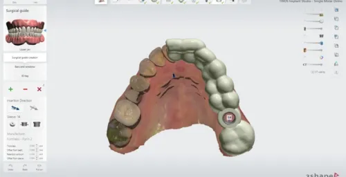 3shape Dental System 2022 + 3Shape Unite 2022 + 3shapeOrtho System 2022 + 3Shape Implant Studio 22 