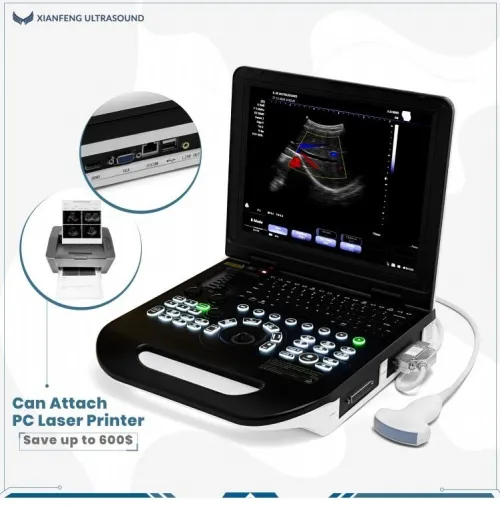 Le plus fiable , le plus rentable l'ECHOGRAPHIE PORTABLE Doppler Couleur XIANFENG E30 