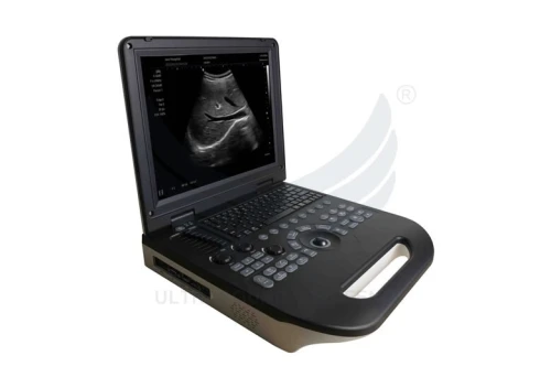 Le plus fiable , le plus rentable l'ECHOGRAPHIE PORTABLE Doppler Couleur XIANFENG E30 