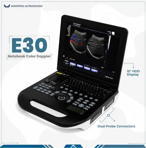 Le plus fiable , le plus rentable l'ECHOGRAPHIE PORTABLE Doppler Couleur XIANFENG E30 