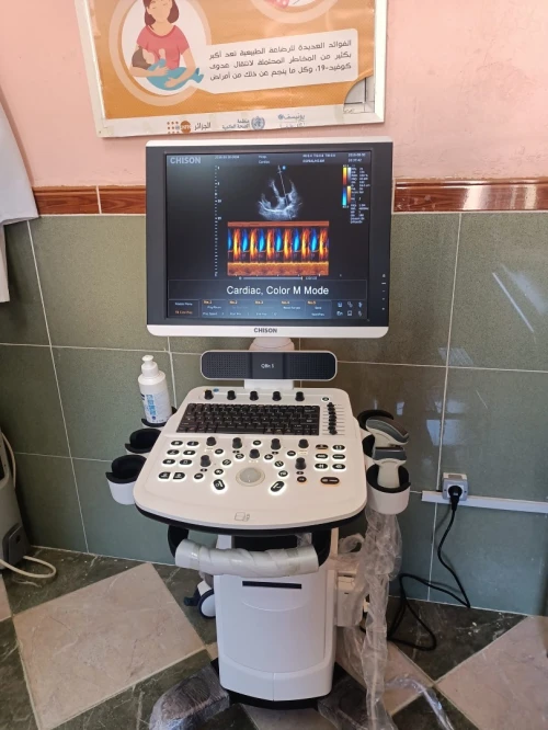 Echo Doppler CHISON 