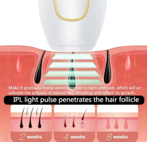 Épilateur Laser IPL