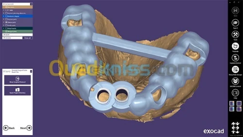 EXOCAD 3.1 EXOPLAN PARTIALCAD