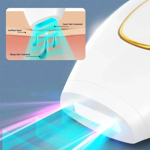 IPL Beauty Laser-مزيل شعر بدقة عالية-بتقنية الليزر عالي الجودة